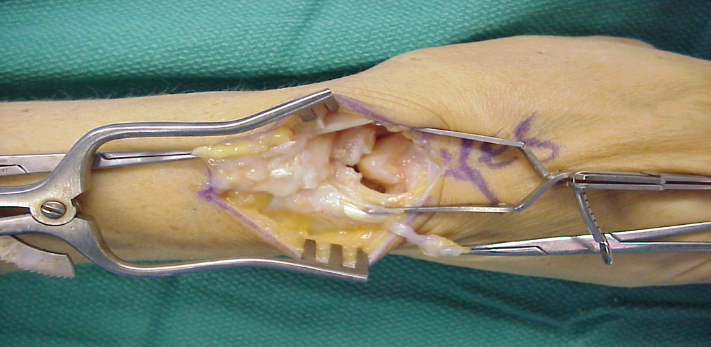 Hand Wrist Ankle And Foot Microsurgeon